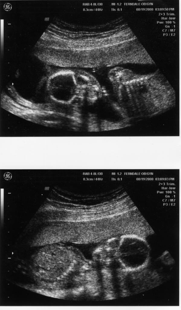 plus 2: Ultrasound Progression